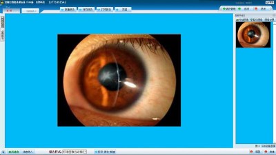 ��϶��D��̎��ϵ�y