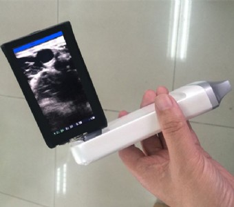 xprobeϵ�Ў����o��̽�^ʽb���S��ֱ�I